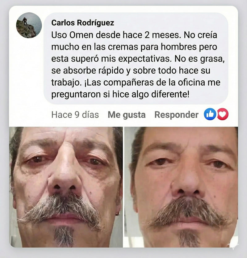 Carlos Rodriguez - resultado