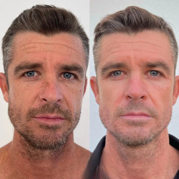 Daniel M., 51 años — 30 días