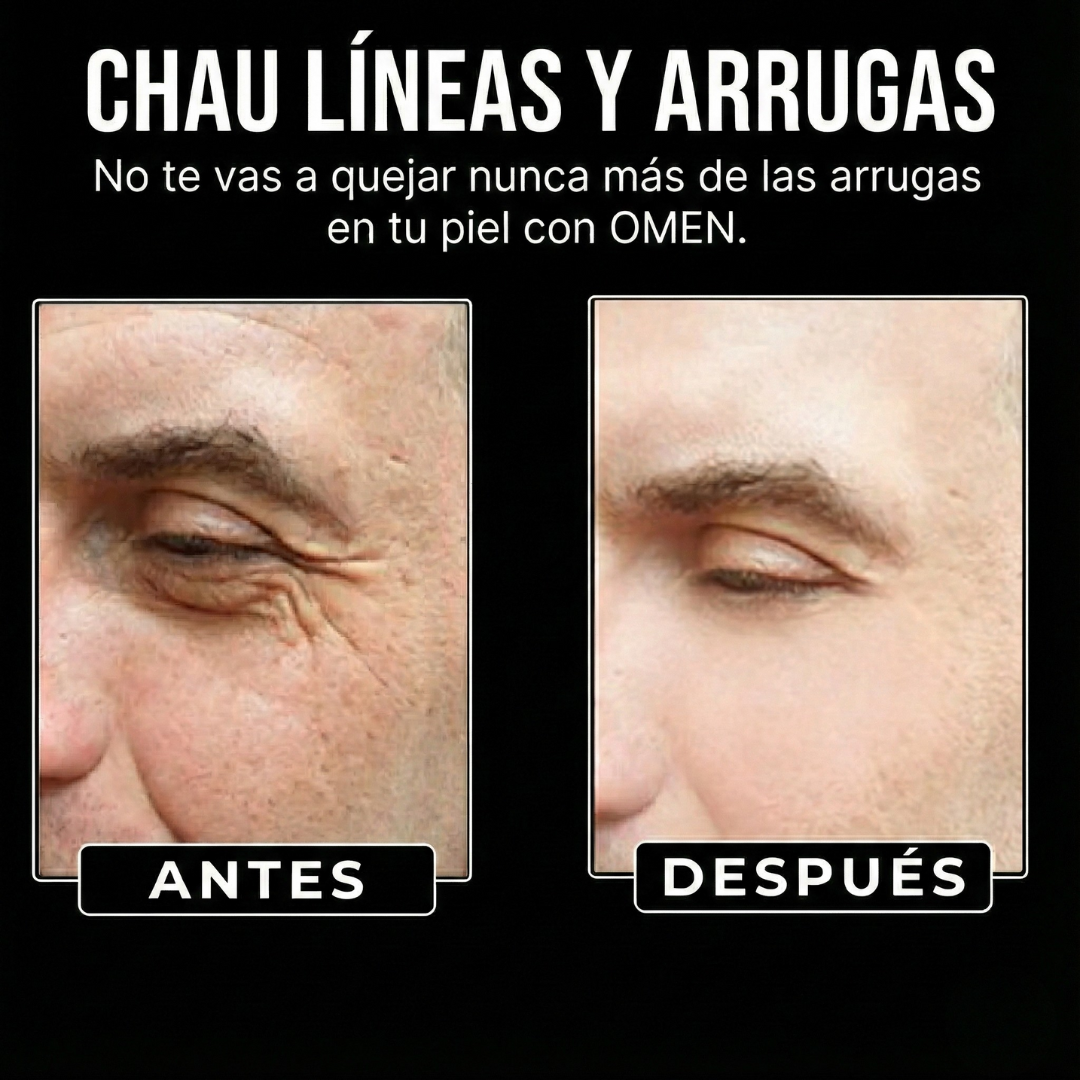 Omen Serum anti-edad para Hombres
