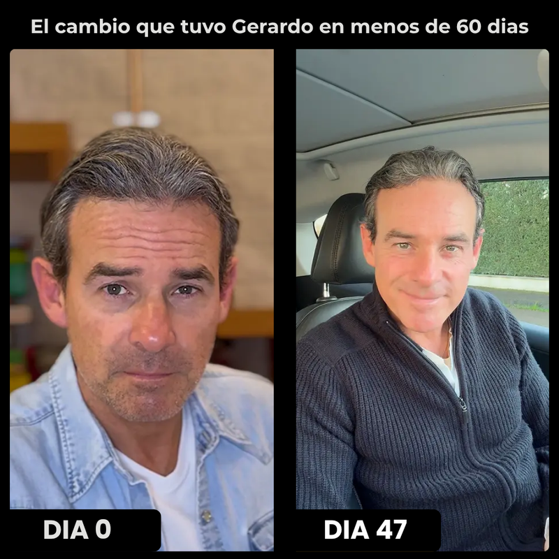 OMEN Serum anti-edad para Hombre